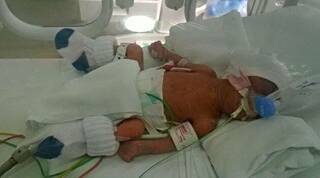 La Virgen de Guadalupe salvó la vida de un bebé prematuro a quien los médicos ya casi daban por desahuciado
