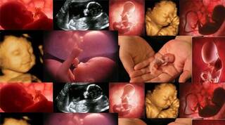 Más de 62 millones de seres humanos asesinados por aborto en U.S.A. luego del viciado proceso jurídico Roe vs. Wade